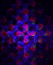 lighting-5
